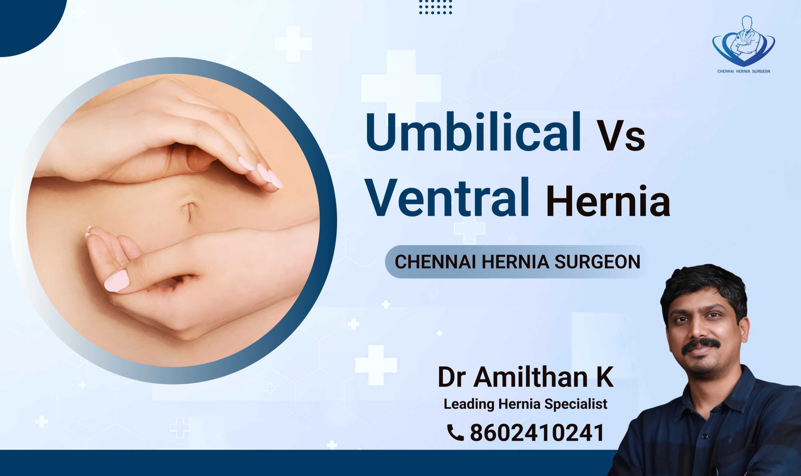 Umbilical vs Ventral hernia